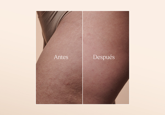 Aceite de Elasticidad Almendra  Antes y Despúes