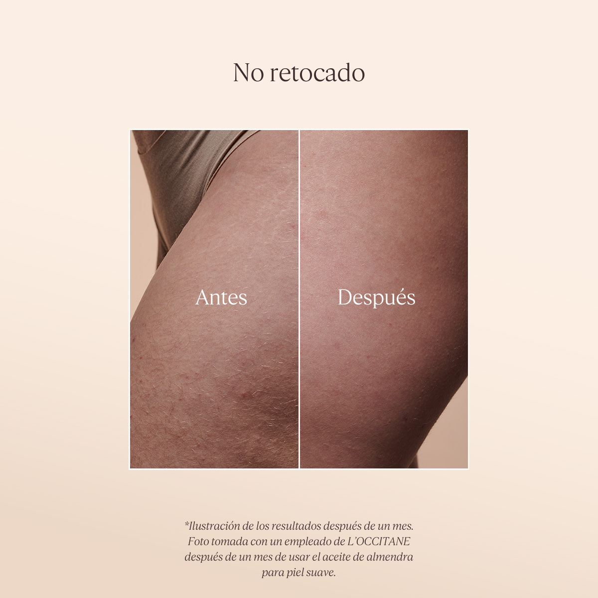 Aceite de Elasticidad Almendra  Antes y Despúes