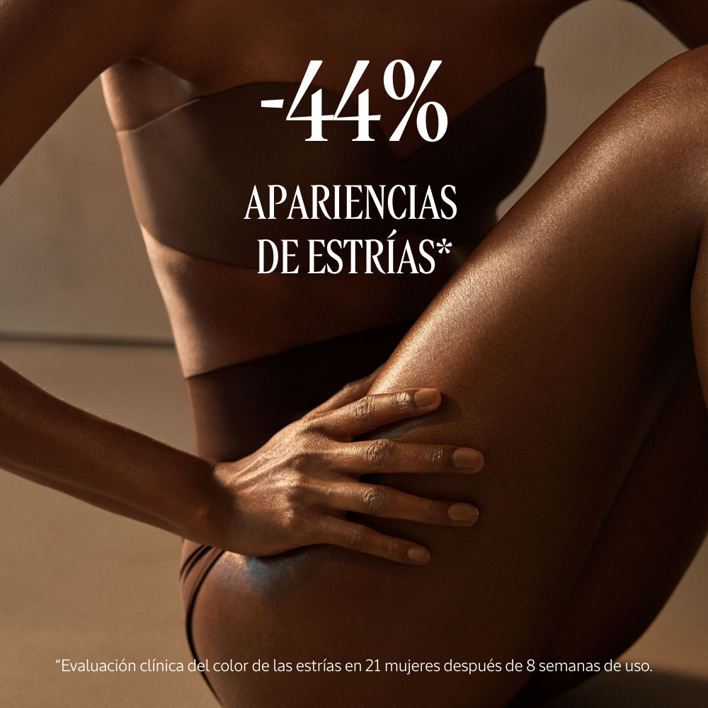 -44% de apariencias de estrías