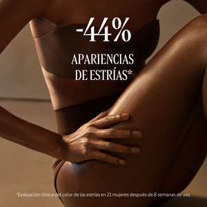 -44% de apariencias de estrías