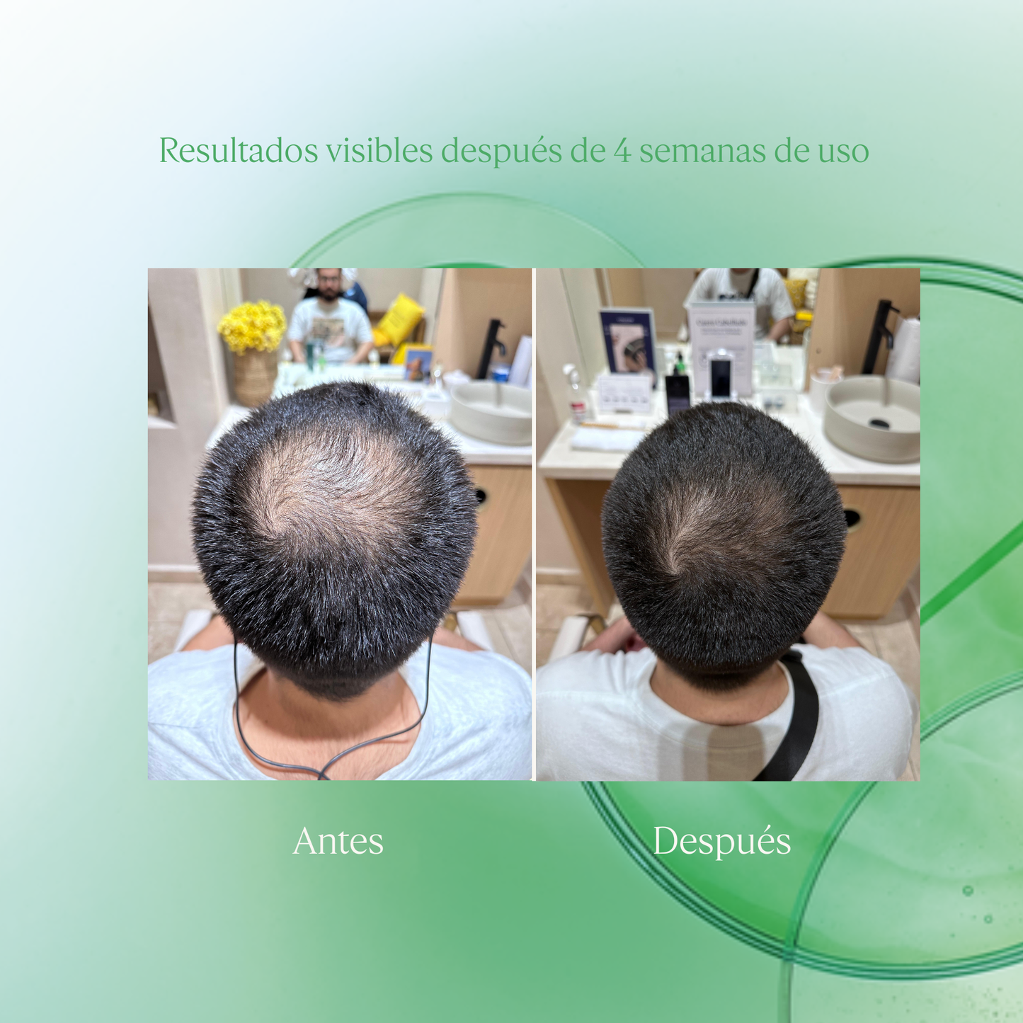 Sérum Capilar Tratamiento Anticaída